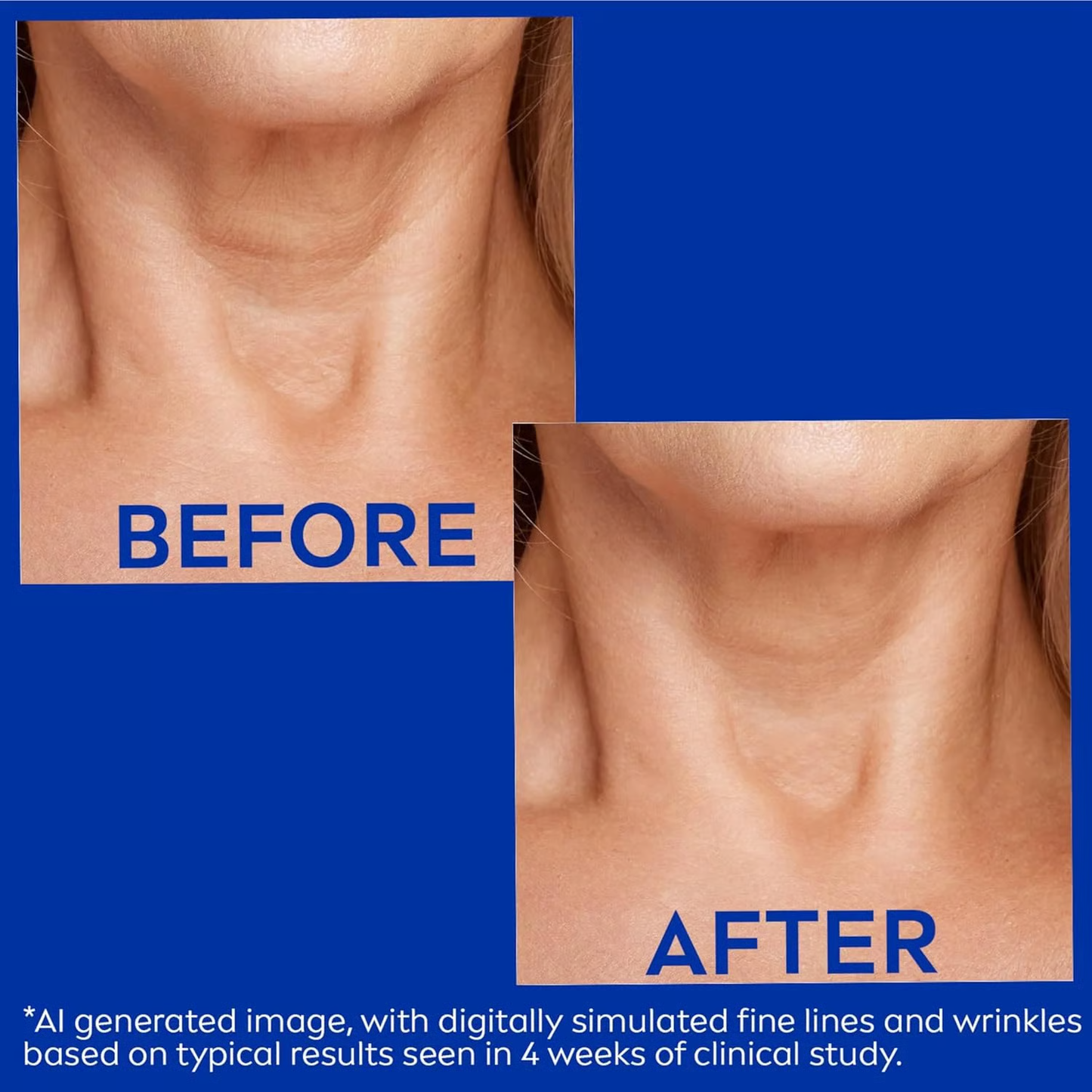 Reduces Wrinkles and Double Chin,Five Rollers for All Around Massage,Neck Firming Cream